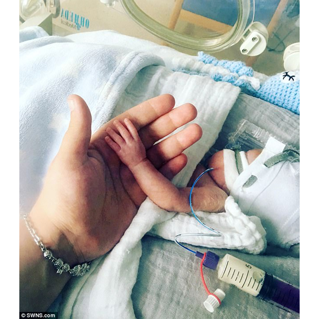 A miracle in a tiny package: premature baby, smaller than the palm of his mother's hand, fights for his life